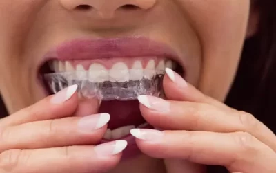 Invisalign Woodland Hills: Clear Aligner Therapy for Discreet Orthodontic Correction
